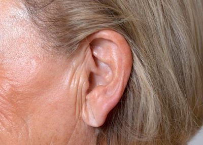 Rughe delle orecchie come si formano e come intervenire?