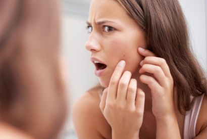 Biotina: come contrastare i danni cutanei dei trattamenti contro l'acne con un integratore per la pelle